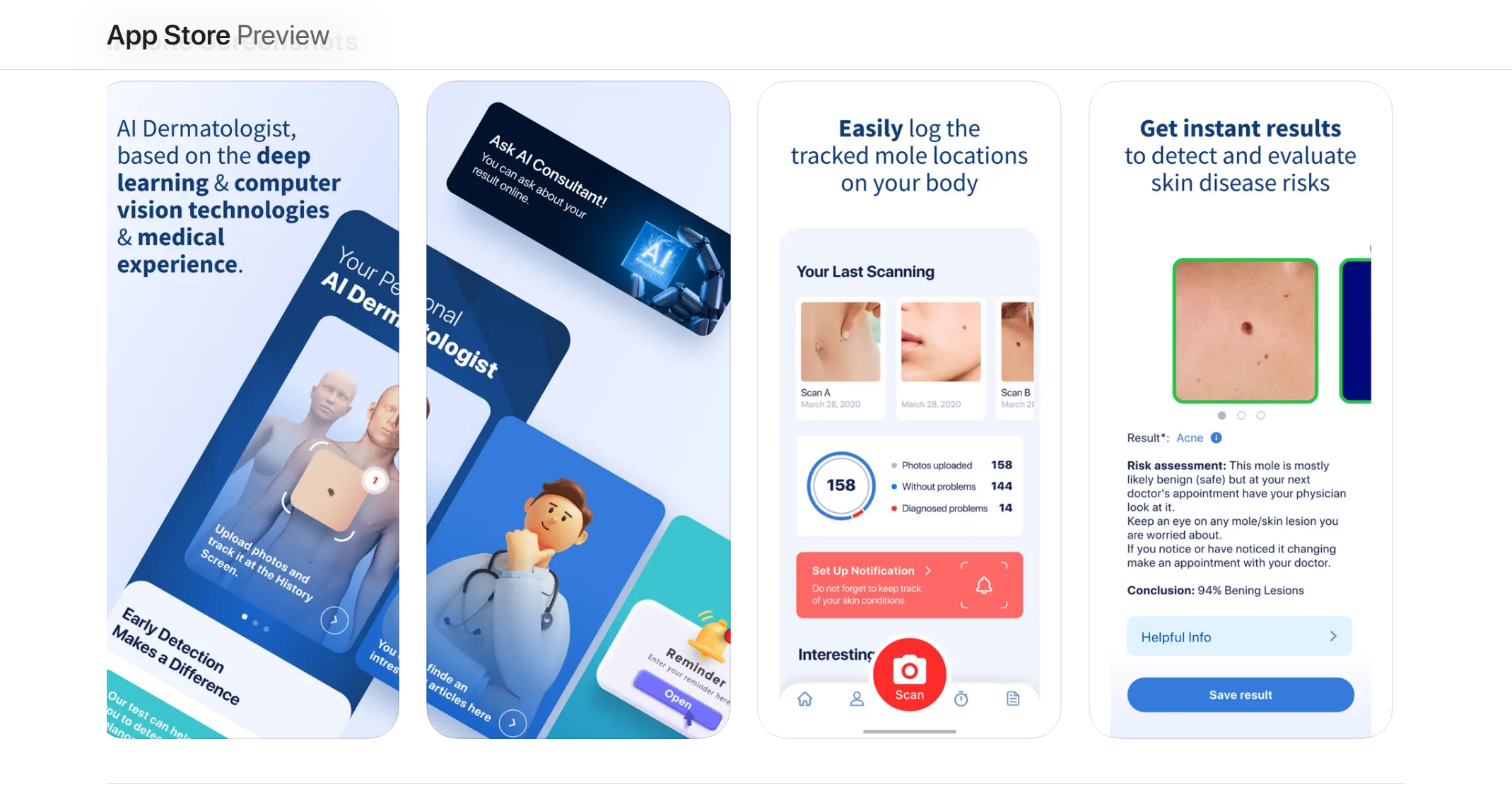 AI Dermatologist